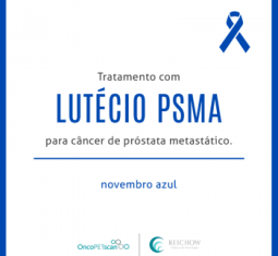 Você conhece o tratamento Lutécio PSMA?