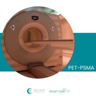 PET-PSMA