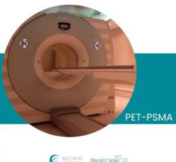 PET-PSMA